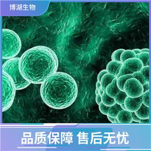 HuNS1人多发性骨髓瘤细胞,Human multiple myeloma cells (MM.1S)