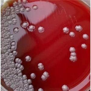 Glomerella CinParaperlucidibaca Baekdonensisgulata,Glomerella CinParaperlucidibaca Baekdonensisgulata