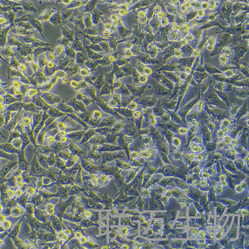 BT-549细胞（人乳腺管癌细胞STR鉴定正确）LM8C0041,BT-549