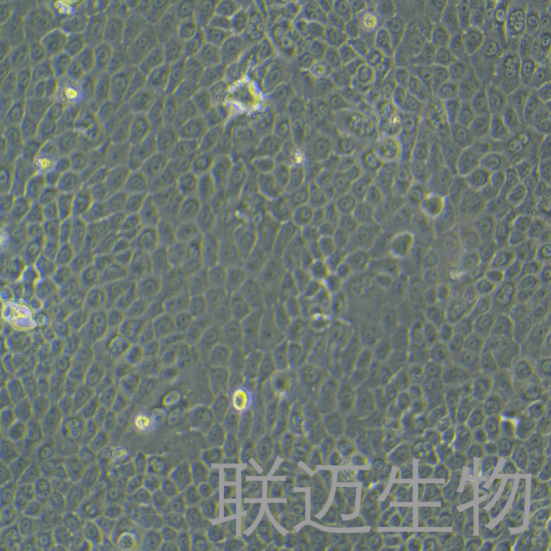 BxPC-3细胞（原位胰腺腺癌细胞STR鉴定正确）LM8C0042,BxPC-3