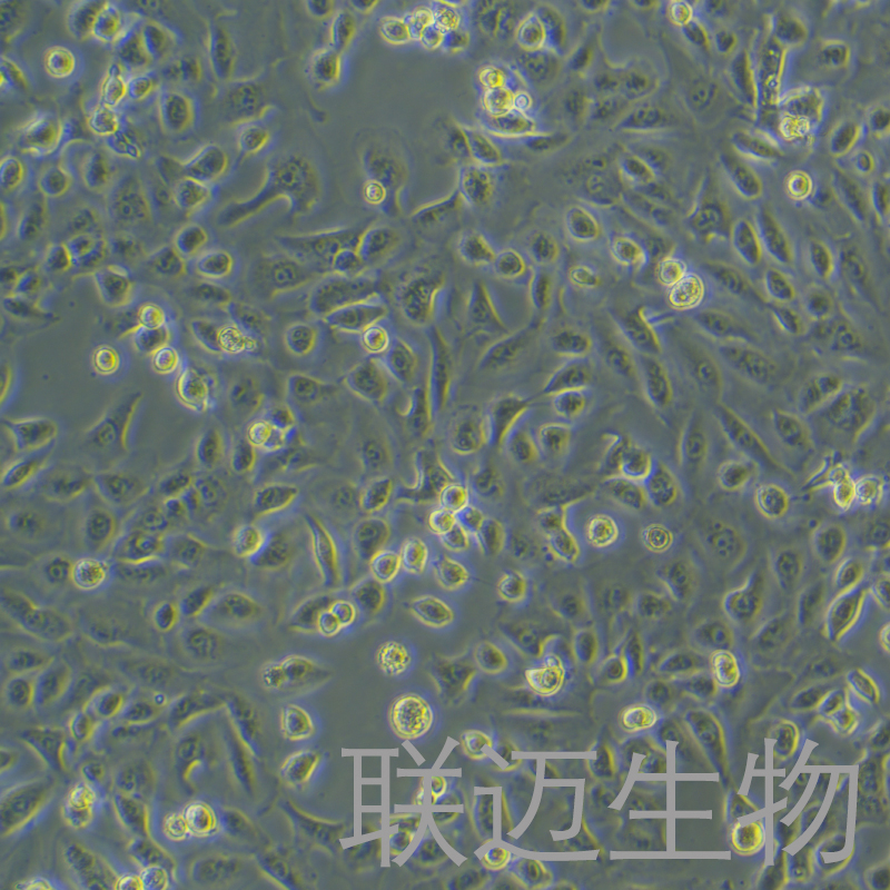 DU145细胞（人前列腺癌细胞STR鉴定正确）LM8C0075,DU145