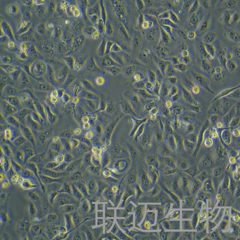 GBC-SD细胞（人胆囊癌细胞STR鉴定正确）LM8C0085,GBC-SD