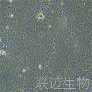 BxPC-3细胞（原位胰腺腺癌细胞STR鉴定正确）LM8C0042,BxPC-3