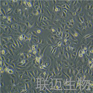 GBC-SD细胞（人胆囊癌细胞STR鉴定正确）LM8C0085