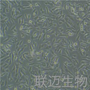 HGC-27细胞（人胃癌细胞未分化STR鉴定正确）LM8C0107