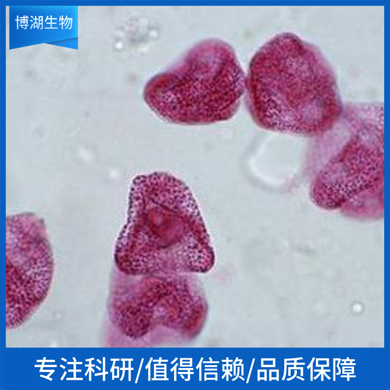 MOLT-4人白血病细胞,MOLT-4