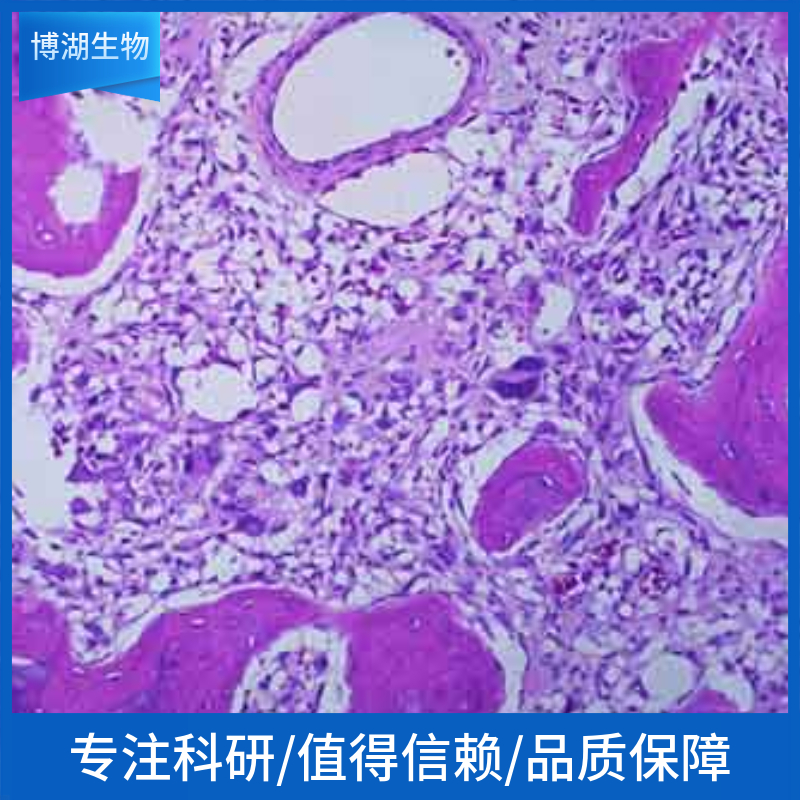 MUTZ-8人急性髓细胞白血病细胞,MUTZ-8 Acute Myeloid Leukemia Cell Line