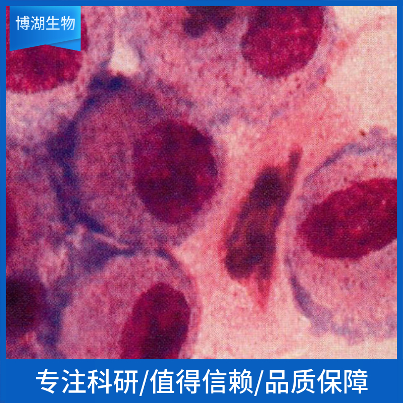 MH-22A小鼠肝癌22A细胞,MH-22A