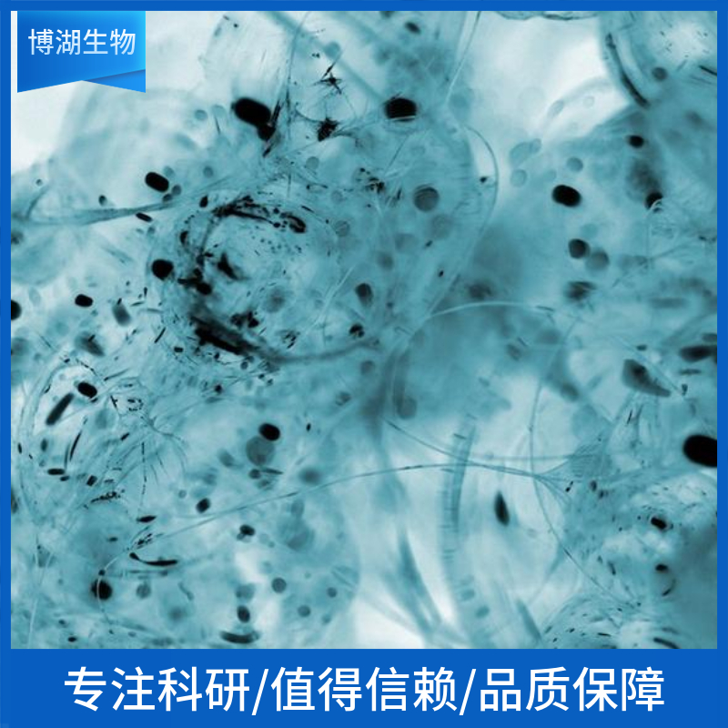 MC116人淋巴癌细胞,MC116