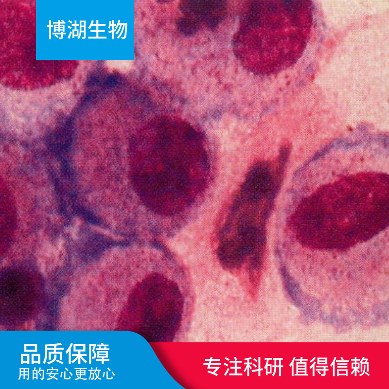 LC-1/sq-SF人非小细胞肺癌细胞,LC-1/sq-SF