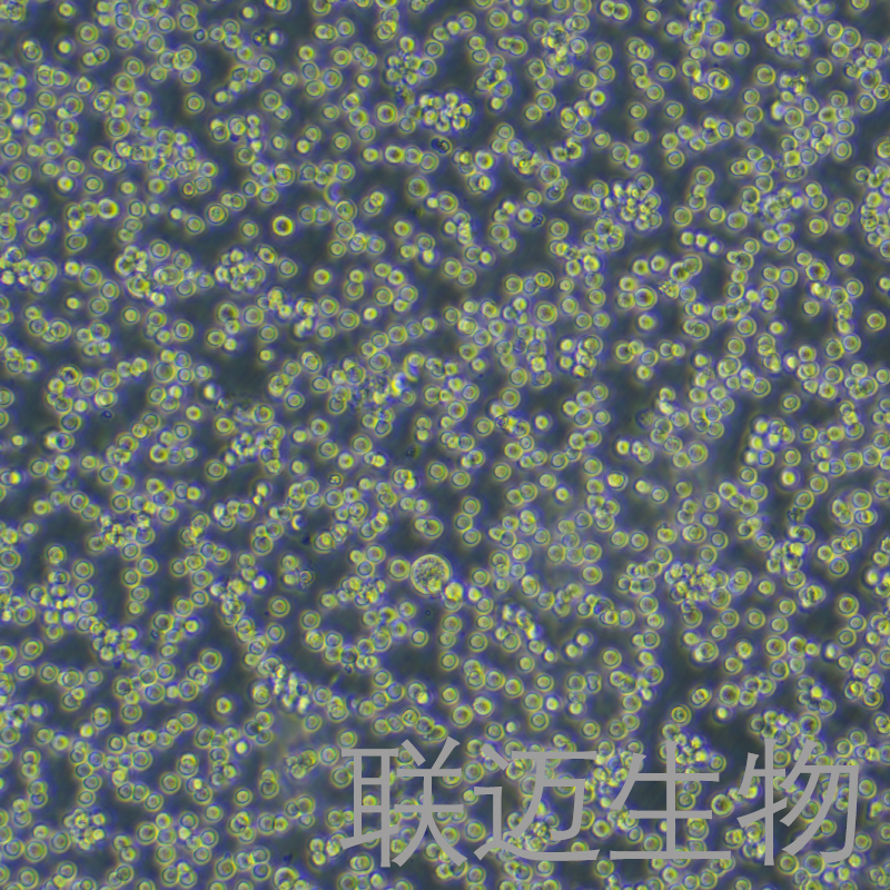Raji细胞（Burkitt's淋巴瘤细胞STR鉴定正确）LM8C0189,Raji