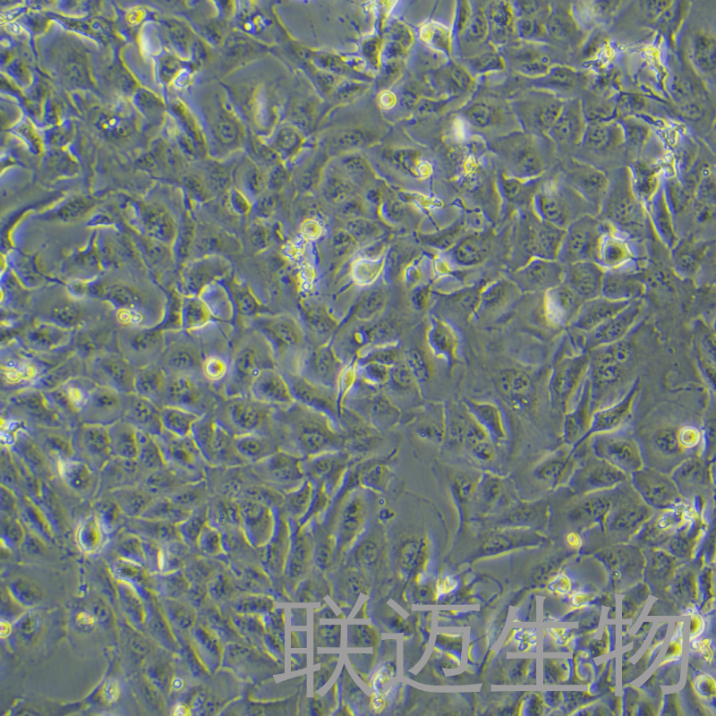RBE细胞（肝胆管癌细胞STR鉴定正确）LM8C0191,RBE