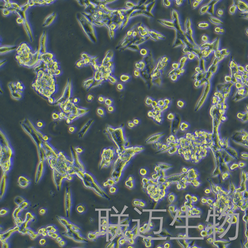 LLC[LL/2;LLC1]细胞（小鼠肺癌细胞种属鉴定正确）LM8C0140,LLC[LL/2;LLC1]