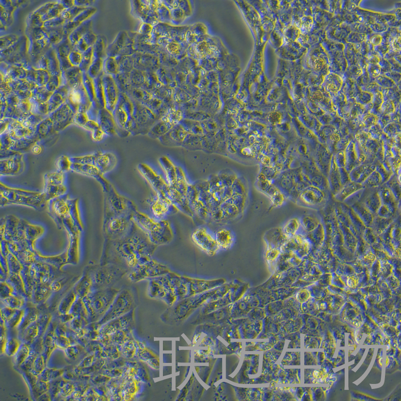 MLTC-1细胞（小鼠睾丸间质细胞瘤细胞种属鉴定正确）LM8C0159,MLTC-1