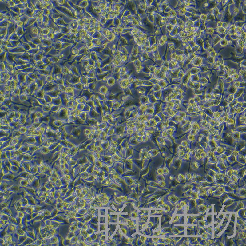 HO-8910细胞（卵巢癌细胞）LM8C0113,HO-8910