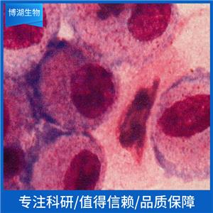 MRK-nu-1人乳腺癌细胞