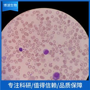 MRK-nu-1人乳腺癌细胞,MRK-nu-1