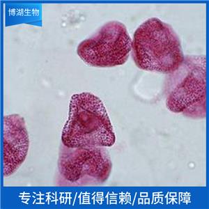 NB16人神经母细胞瘤细胞