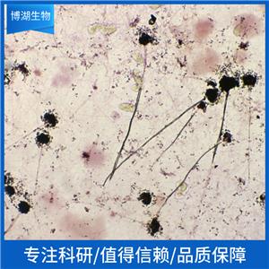 LS411N人直肠癌细胞