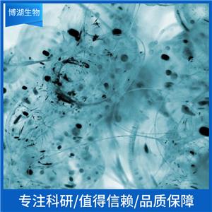 MC116人淋巴癌细胞