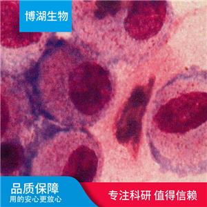 LC-1/sq-SF人非小细胞肺癌细胞