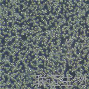 Raji细胞（Burkitt's淋巴瘤细胞STR鉴定正确）LM8C0189