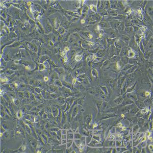 RBE细胞（肝胆管癌细胞STR鉴定正确）LM8C0191