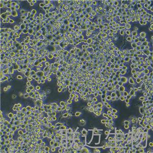 Neuro-2a[N2a;Neuro-2a]细胞（小鼠脑神经瘤细胞种属鉴定正确）LM8C0168,Neuro-2a[N2a;Neuro-2a]