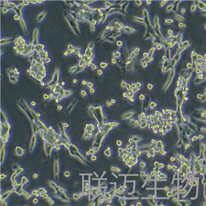 LLC[LL/2;LLC1]细胞（小鼠肺癌细胞种属鉴定正确）LM8C0140