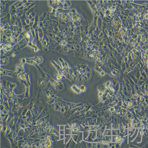 MLTC-1细胞（小鼠睾丸间质细胞瘤细胞种属鉴定正确）LM8C0159