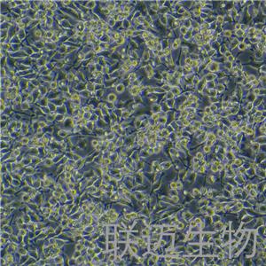 HO-8910细胞（卵巢癌细胞）LM8C0113