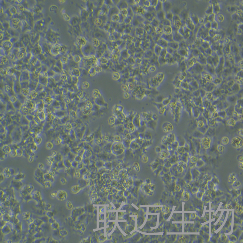 JAR细胞（人胎盘绒毛癌细胞STR鉴定正确）LM8C0126,JAR