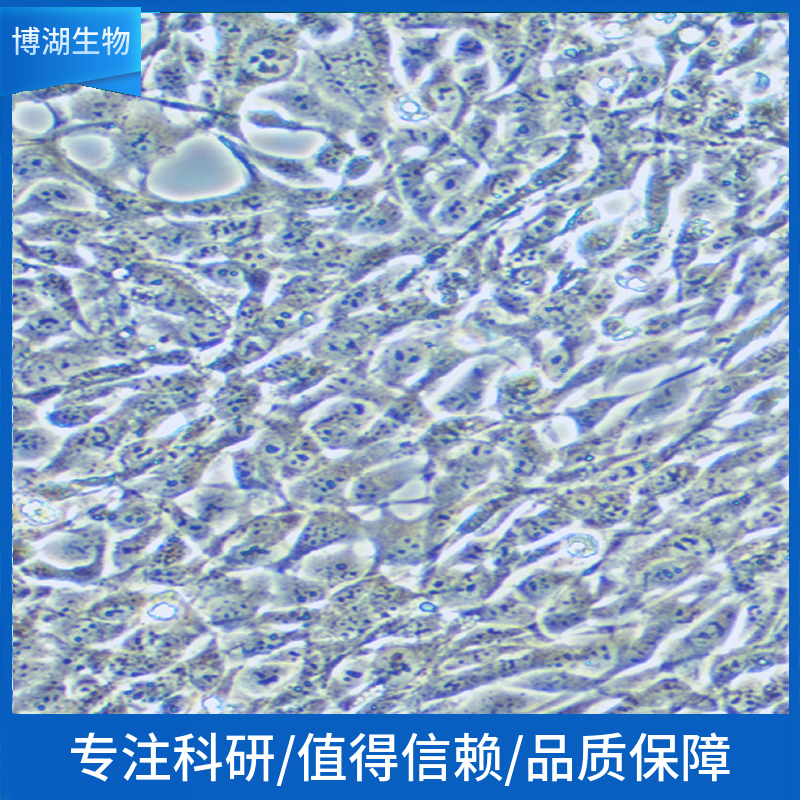 KM12人结肠癌细胞,KM12 (Human Colon Cancer Cells)