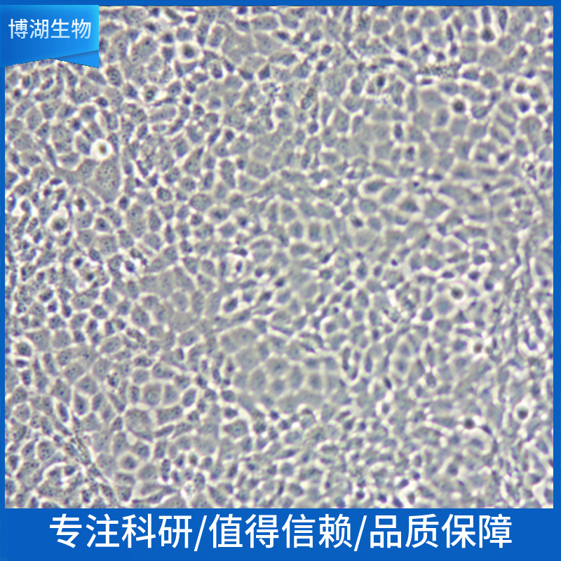 KS-1人脑部多形性成釉细胞瘤细胞,KS-1