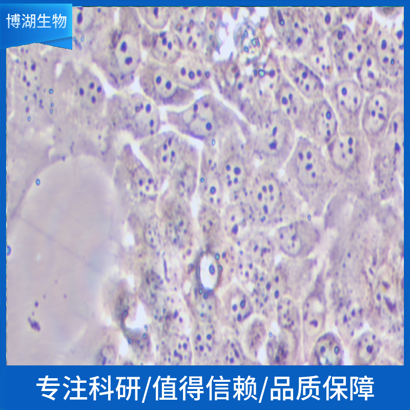KYSE-520人食管鳞状细胞癌细胞,KYSE-520 (Human Esophageal Squamous Cell Carcinoma Cell Line)
