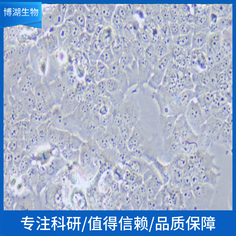HT人淋巴癌细胞,HT