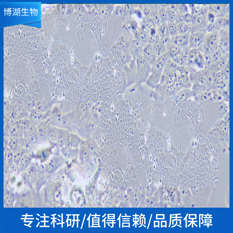 Huh7.5人肝癌细胞,Huh7.5