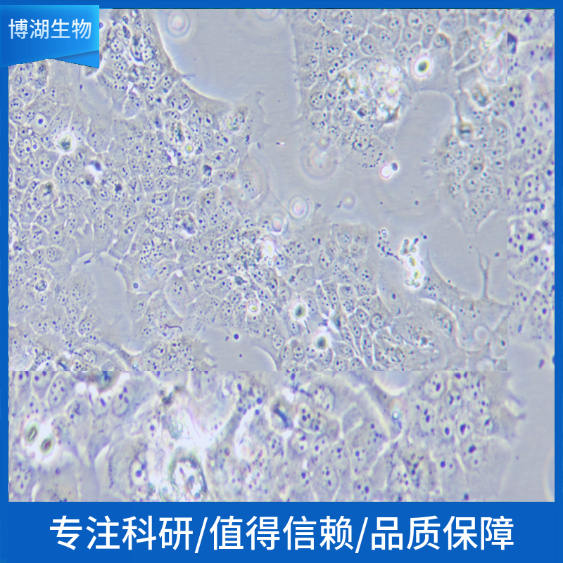 IGR-1人黑素瘤细胞,IGR-1