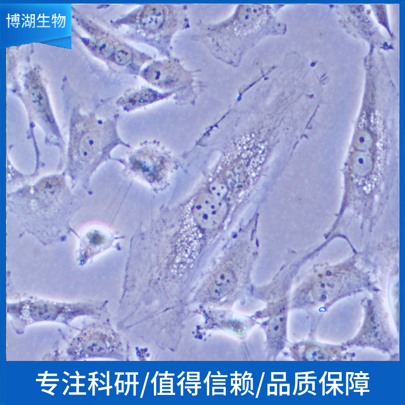 Ishikawa人子宫内膜腺癌细胞,Ishikawa
