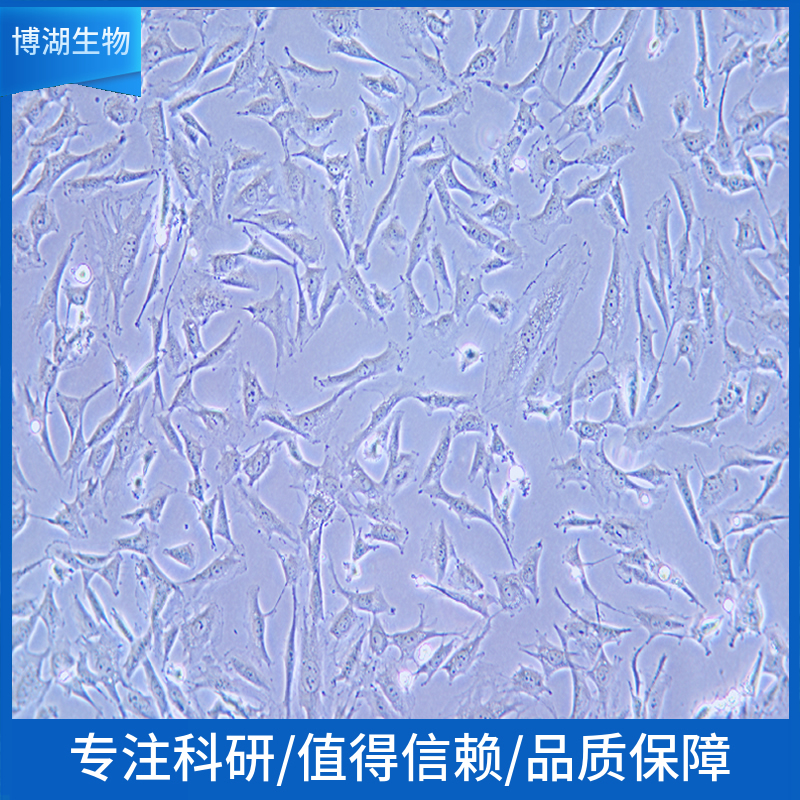 Jiyoye人淋巴癌细胞,Jiyoye