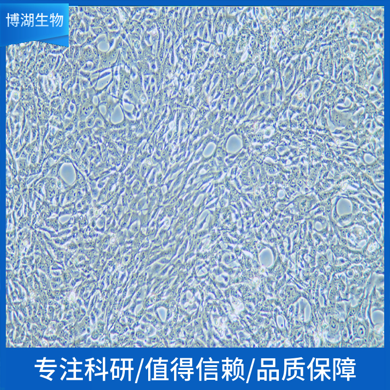 HEC265人子宫内膜腺癌细胞,HEC265