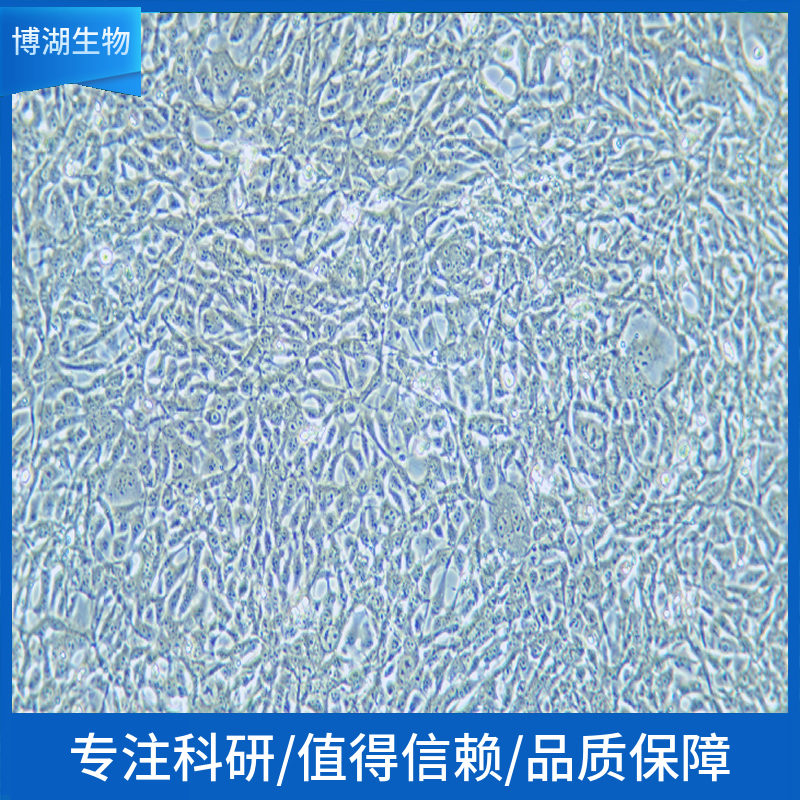 HEY人高级别浆液性卵巢癌细胞,HEY