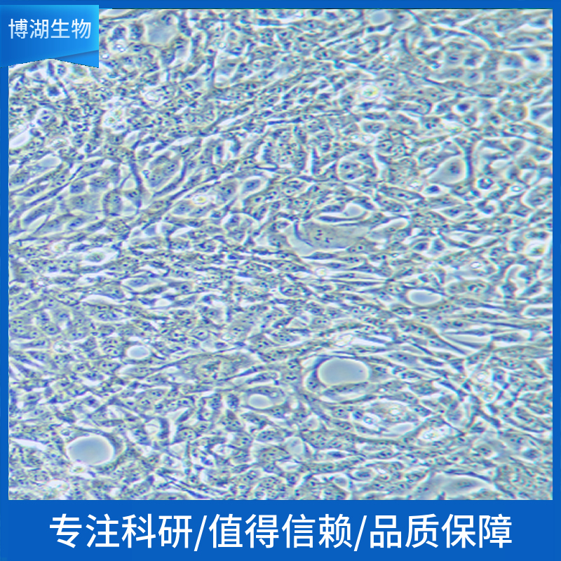 HL-60 Clone 15人白血病细胞,HL-60 Clone 15