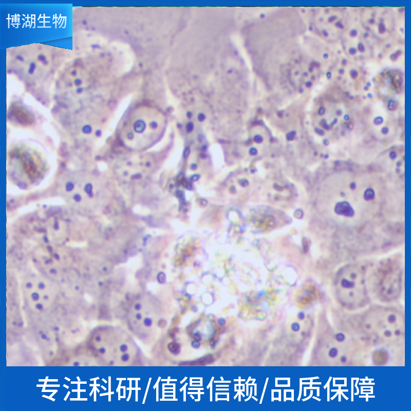 HSC-4人头颈部鳞状细胞癌细胞,HSC-4