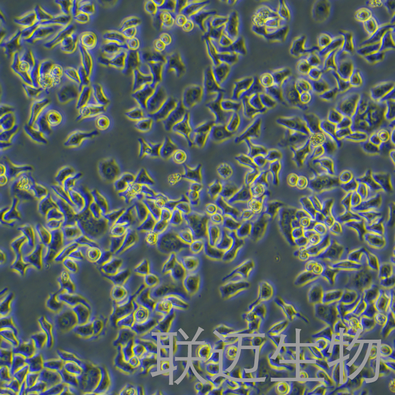 HCCLM3细胞（高转移肝癌细胞）LM8C0278,HCCLM3