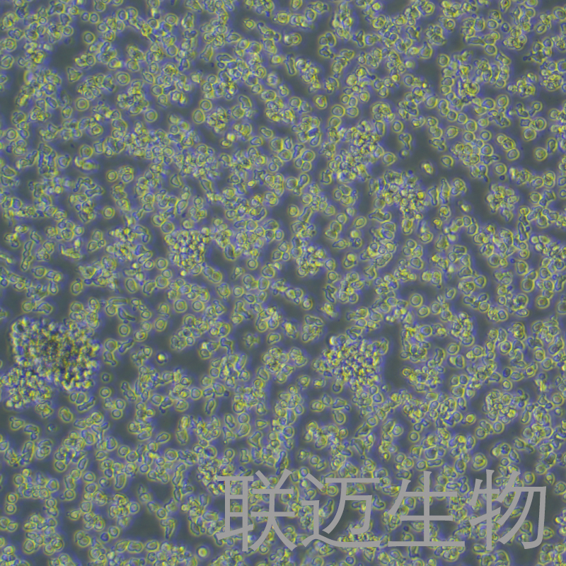 YAC-1细胞（小鼠淋巴瘤细胞）LM8C0246,YAC-1