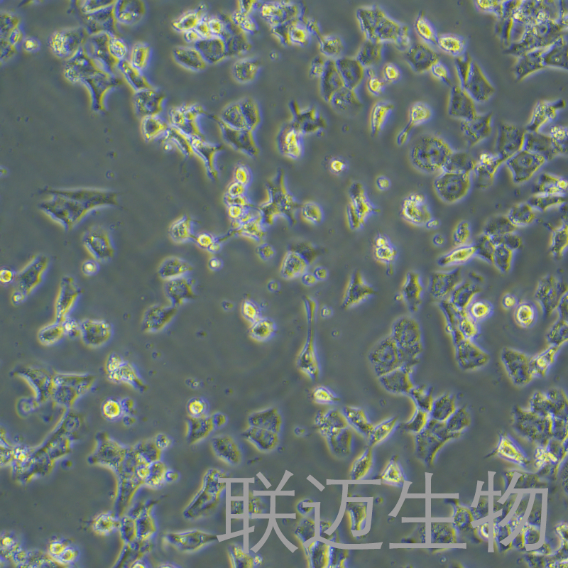 RH-35细胞（大鼠肝癌细胞种属鉴定正确）LM8C0195,RH-35