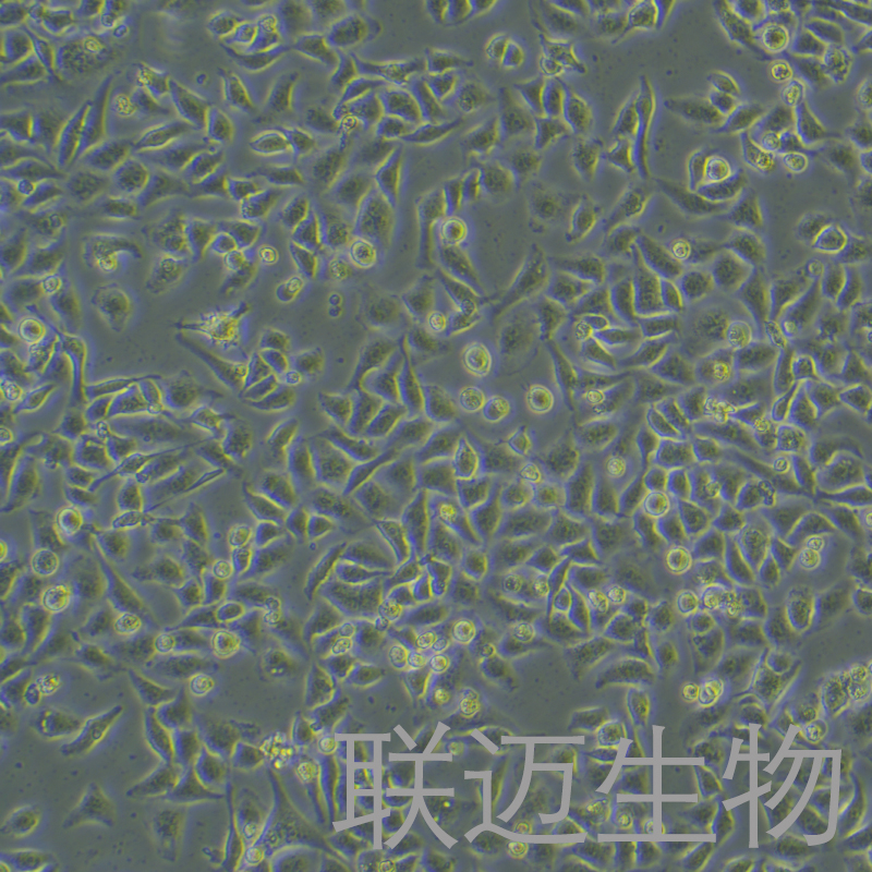 SMMC-7721细胞（肝癌细胞）LM8C0216,SMMC-7721