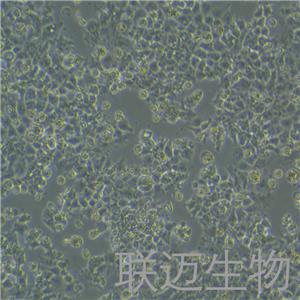 JAR细胞（人胎盘绒毛癌细胞STR鉴定正确）LM8C0126