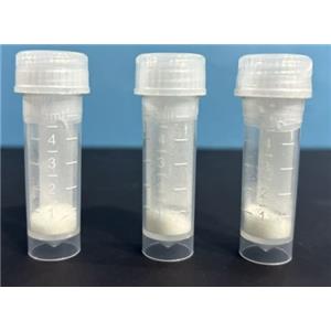 腺苷脱氨酶（ADA）,adenosine deaminase